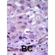 Retinol (RET) Antibody