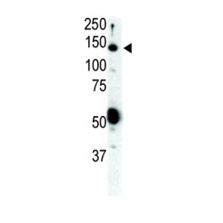 Retinol (RET) Antibody