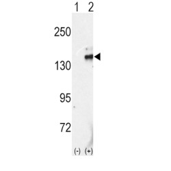 Retinol (RET) Antibody