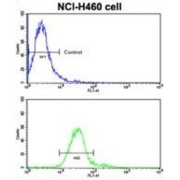 Receptor Tyrosine Kinase Like Orphan Receptor 1 (ROR1) Antibody