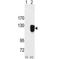 Receptor Tyrosine Kinase Like Orphan Receptor 1 (ROR1) Antibody