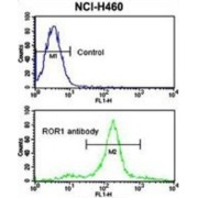 Receptor Tyrosine Kinase Like Orphan Receptor 1 (ROR1) Antibody