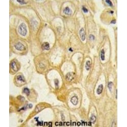 Receptor Tyrosine Kinase Like Orphan Receptor 1 (ROR1) Antibody