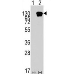 Receptor Tyrosine Kinase Like Orphan Receptor 1 (ROR1) Antibody