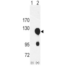 Receptor Tyrosine Kinase Like Orphan Receptor 2 (ROR2) Antibody