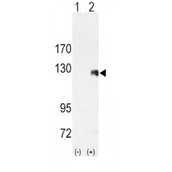 Receptor Tyrosine Kinase Like Orphan Receptor 2 (ROR2) Antibody