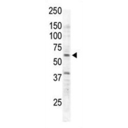 Tyrosine-Protein Kinase RYK (RYK) Antibody