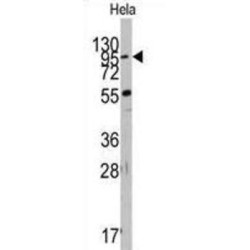 Tyrosine-Protein Kinase Receptor TYRO3 (TYRO3) Antibody