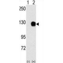 Tyrosine-Protein Kinase Receptor TYRO3 (TYRO3) Antibody