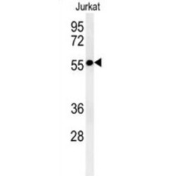 Serine/Threonine Kinase 33 (STK33) Antibody