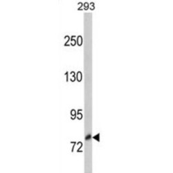 GP145-TrkC (TRKC) Antibody