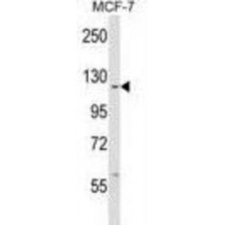 Tyrosine-Protein Kinase ABL1 (c ABL) Antibody