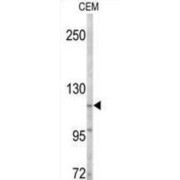 Activated CDC42 Kinase 1 (ACK1) Antibody