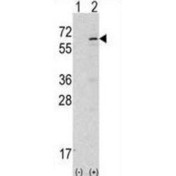 Activated CDC42 Kinase 1 (ACK1) Antibody