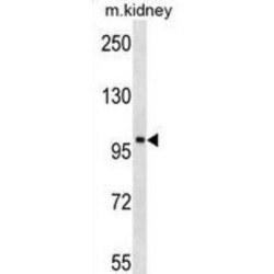 Activated CDC42 Kinase 1 (ACK1) Antibody