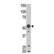 Tyrosine-Protein Kinase BLK (BLK) Antibody