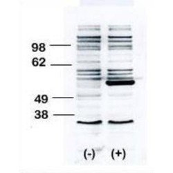 Tyrosine-Protein Kinase BLK (BLK) Antibody