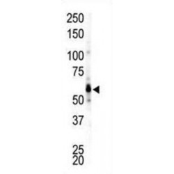 Tyrosine-Protein Kinase Fgr (FGR) Antibody