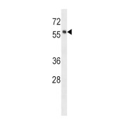 Tyrosine Protein Kinase HCK (HCK) Antibody