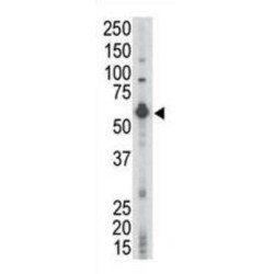 Proto-Oncogene Tyrosine-Protein Kinase LCK (LCK) Antibody