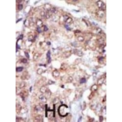 V-Yes-1 Yamaguchi Sarcoma Viral Related Oncogene Homolog (LYN) Antibody