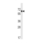 Megakaryocyte Associated Tyrosine Kinase (MATK) Antibody