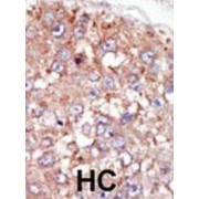 Protein Tyrosine Kinase 6 (PTK6) Antibody
