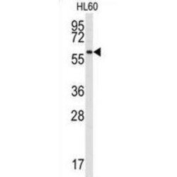 Tyrosine-Protein Kinase Srms (SRMS) Antibody