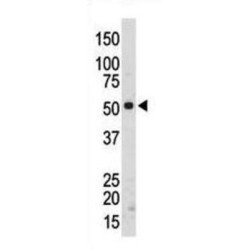 Tyrosine-Protein Kinase Srms (SRMS) Antibody