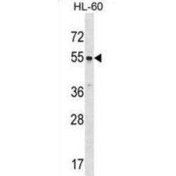 Tyrosine-Protein Kinase Srms (SRMS) Antibody