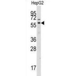 G Protein-Coupled Receptor Kinase 7 (GRK7) Antibody