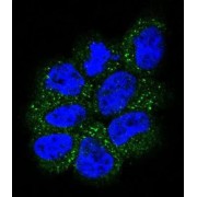 GTPase NRas (NRAS) Antibody