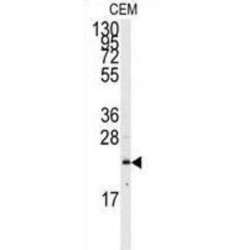 GTPase NRas (NRAS) Antibody