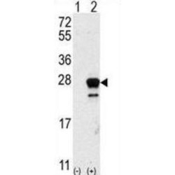 GTPase NRas (NRAS) Antibody