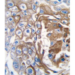 GTPase NRas (NRAS) Antibody