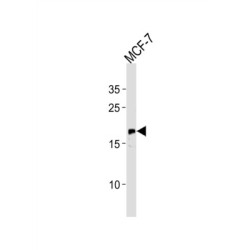 GTPase NRas (NRAS) Antibody