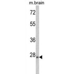 Rho-Related GTP-Binding Protein RhoE (ARHE) Antibody