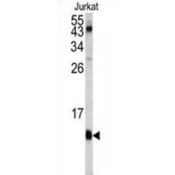 FK506 Binding Protein 1A (FKBP1A) Antibody