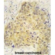 Semaphorin 3A (SEMA3A) Antibody