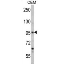 Semaphorin 3A (SEMA3A) Antibody