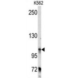 Protein Bicaudal D Homolog 2 (BICD2) Antibody