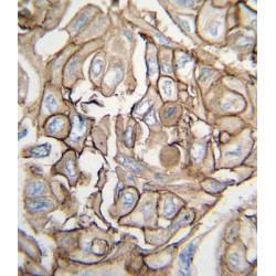 GTPase HRas (HRAS) Antibody