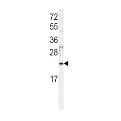 GTPase HRas (HRAS) Antibody