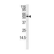 Calcium/Calmodulin Dependent Protein Kinase Kinase 1 (CAMKK1) Antibody