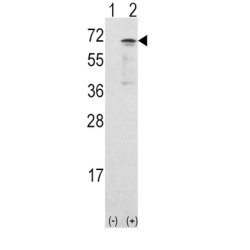 Calcium/Calmodulin Dependent Protein Kinase Kinase 1 (CAMKK1) Antibody