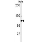 Alpha Actinin 4 (ACTN4) Antibody