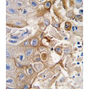 Cytochrome P450 2W1 (CYP2W1) Antibody