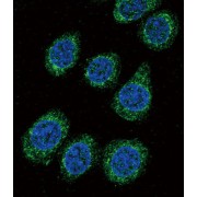 Cytochrome P450 3A5 (CYP3A5) Antibody