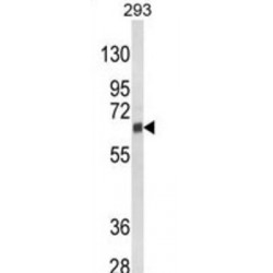 Cytochrome P450 3A5 (CYP3A5) Antibody