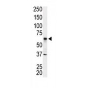 Interleukin 1 Receptor Associated Kinase 2 (IRAK2) Antibody